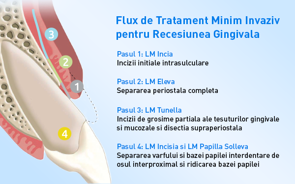 info-2-LM-Dental-Dentstore-2025